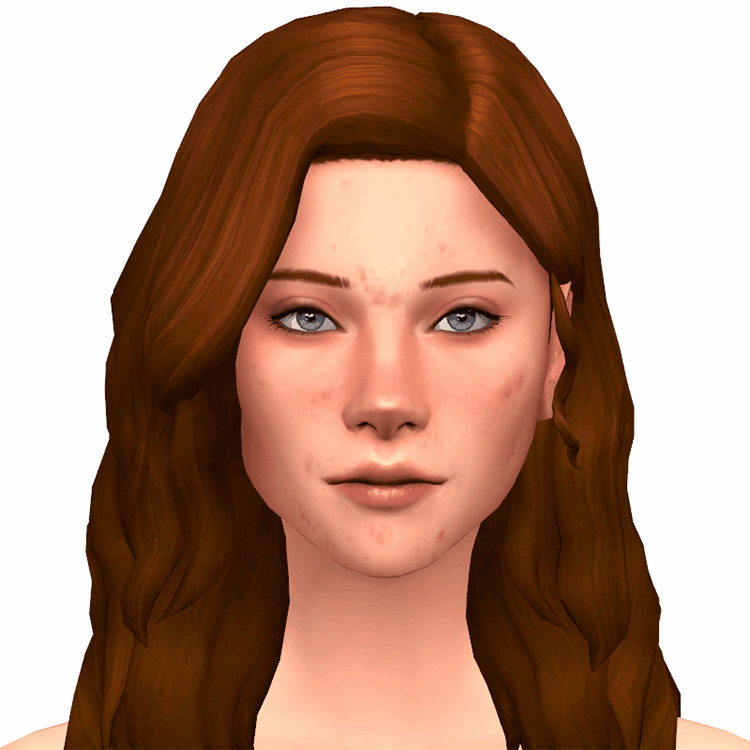 Real Skin Acne / Sims 4 CC
